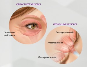 BotoxMuscles